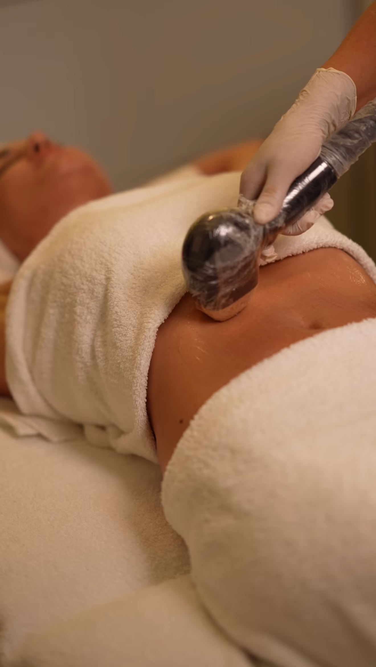 إزالة الشعر بالليزر - Fatma Süha Beauty & Skincare Expert - Wellness